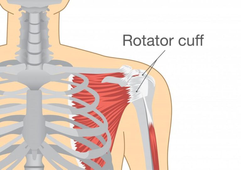 Rotator Cuff Sendromu Nedir? Rotator Cuff Kasları Nelerdir?
